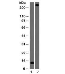 VWF / Von Willebrand Factor Antibody (clone VWF/1465)