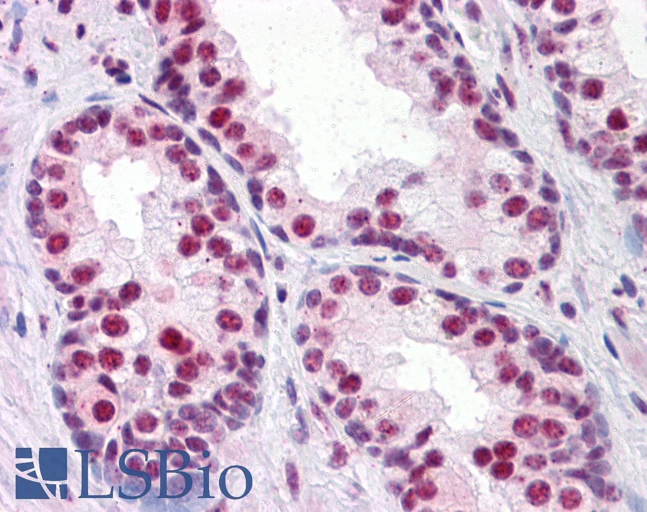 PathPlus™ Monoclonal Mouse anti-Human CBFA1 / RUNX2 Antibody (clone 1D2, IHC, IF, WB)