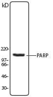 PARP1 Antibody (N-Terminus, clone 5A5)