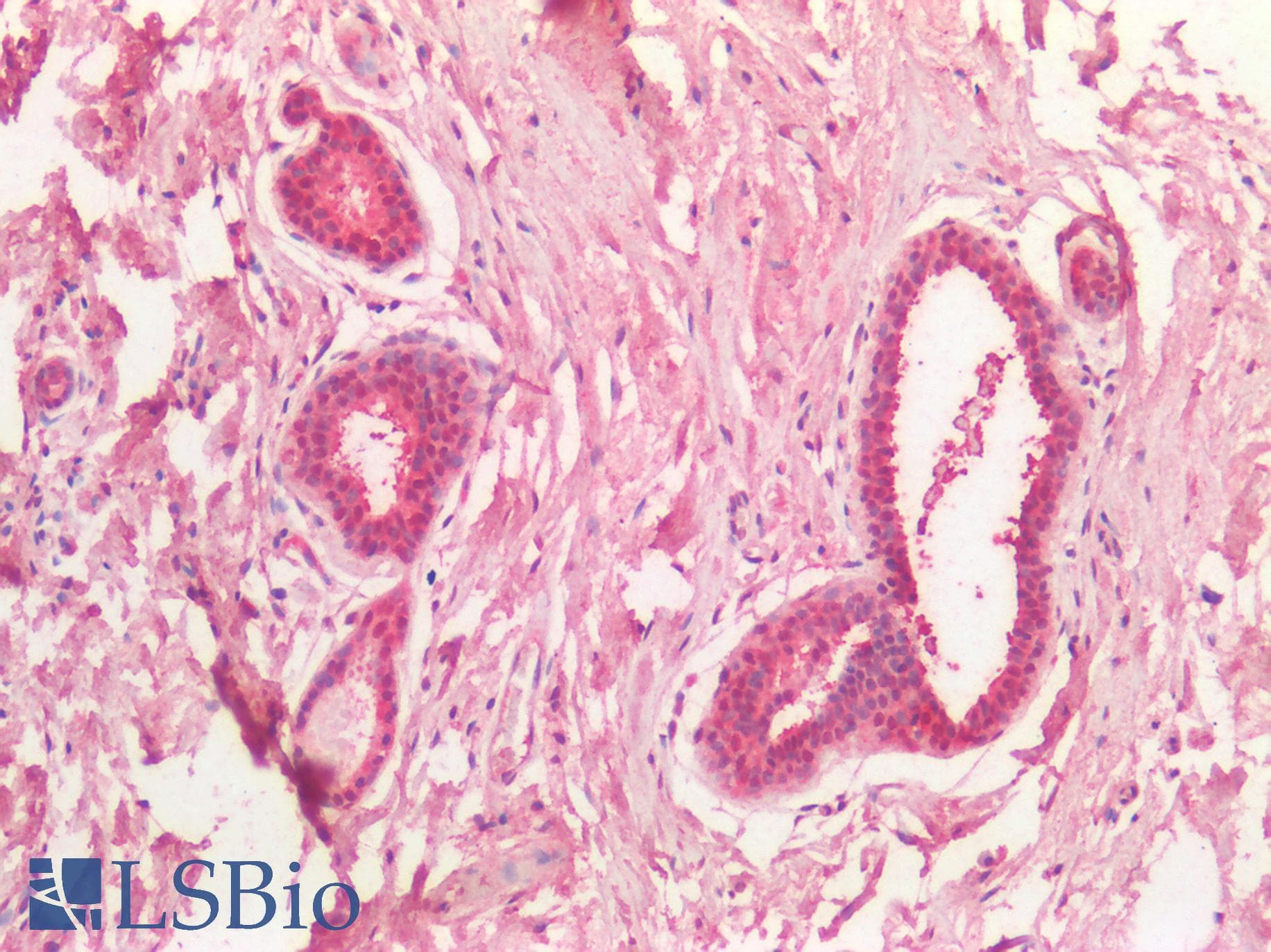 IHC-plus™ MYC / c-Myc Antibody