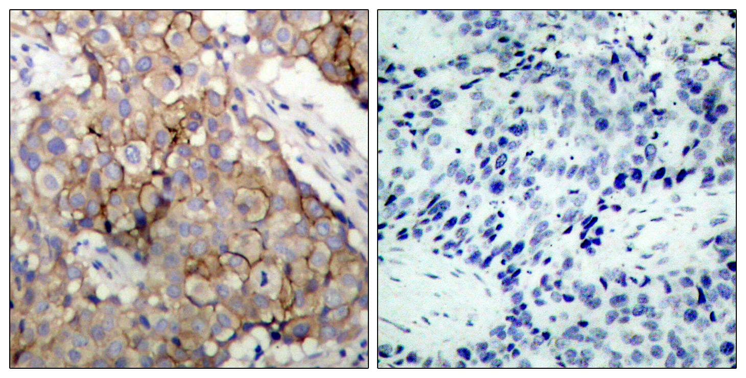 Polyclonal Rabbit anti-Human EGFR Antibody (p1092, IHC, WB)