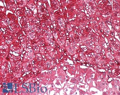 IHC-plus™ BABP / AKR1C2 Antibody (aa296-323)