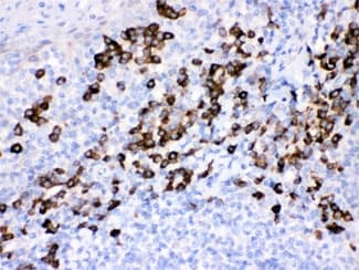 PRDX4 / Peroxiredoxin 4 Antibody