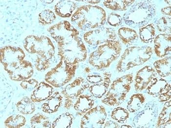 LAMC1 / Laminin Gamma 1 Antibody (clone SPM193)