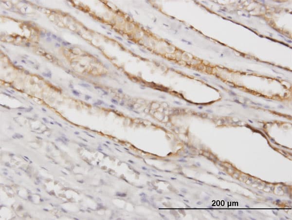Monoclonal Mouse anti-Human PGGT1B Antibody (clone 5E4, IHC, IF, WB)