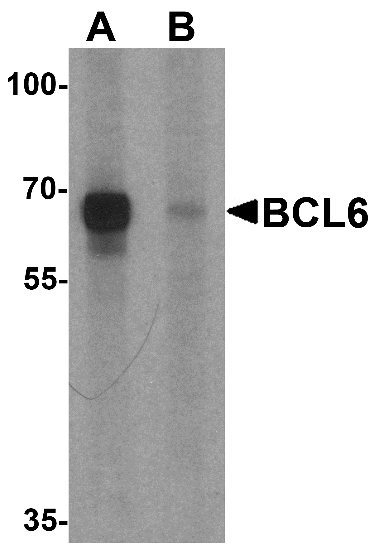 IHC-plus™ BCL6 Antibody