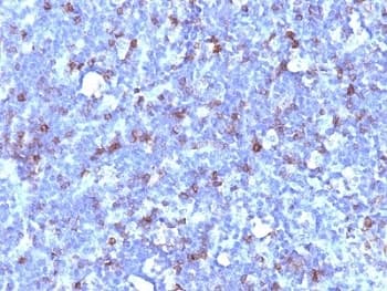 SPN / CD43 Antibody (clone SPN/1094)