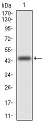 Monoclonal Mouse anti-Human MGMT Antibody (clone 1A11A8, WB)