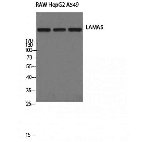 IHC-plus™ LAMA5 / Laminin Alpha 5 Antibody (2350-2430 aa, Internal)