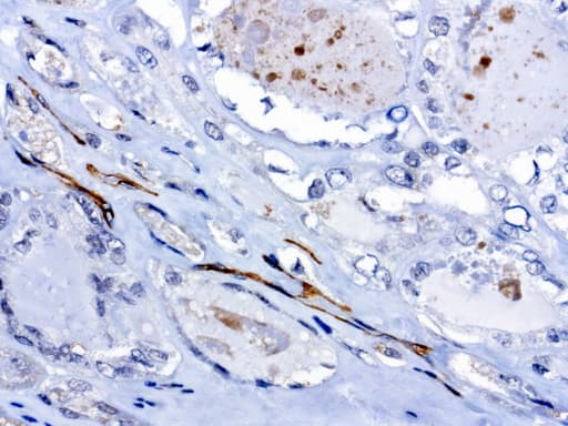 PROCR / EPCR Antibody (aa1-210, clone UMAB200)