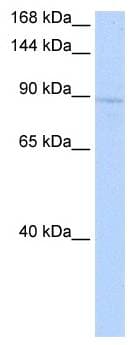 RAB6KIFL / KIF20A Antibody (C-Terminus)