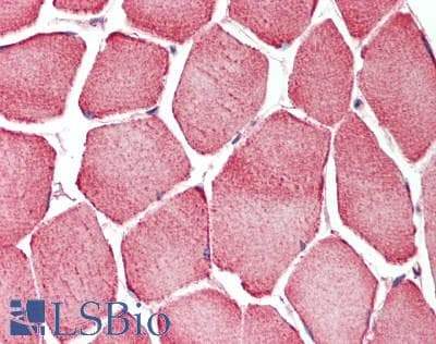IHC-plus™ MAP2K5 / MEK5 Antibody (aa1-190)