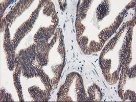 VCAM1 / CD106 Antibody (clone OTI3H10, Carrier-free)