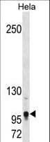 Polyclonal Rabbit anti-Mouse TSHZ1 Antibody (aa639-665, WB)