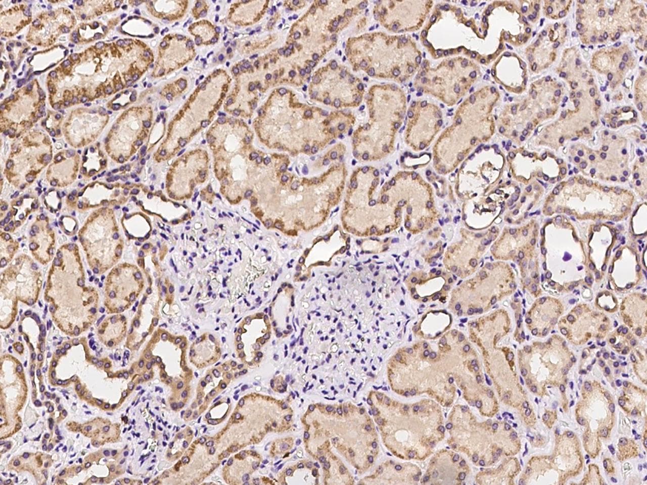 CALCOCO2 Antibody