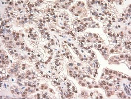 MYC / c-Myc Antibody (clone OTI5G3)