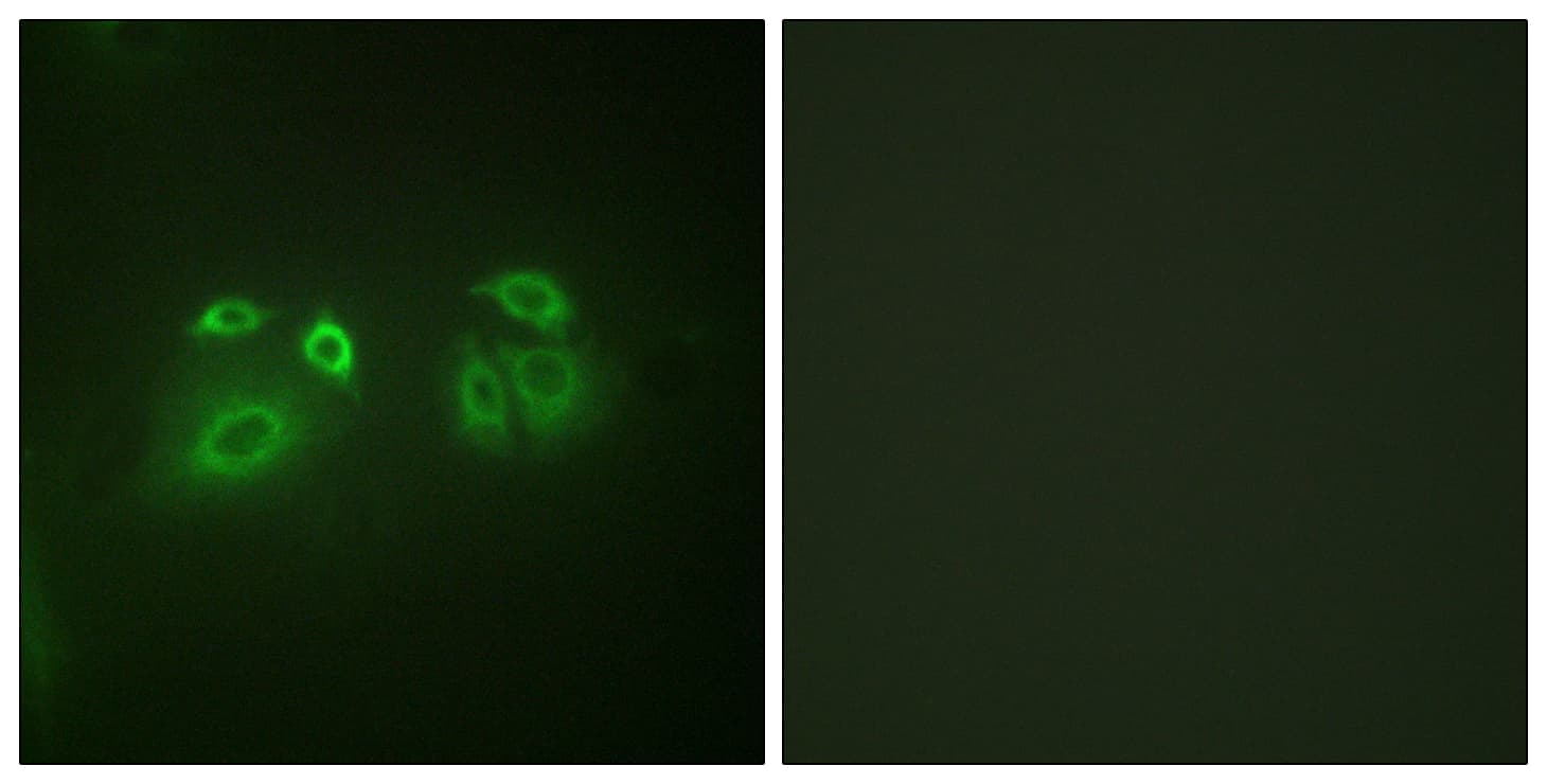 Polyclonal Rabbit anti-Human ARRB1 / Beta Arrestin 1 Antibody (aa369-418, IHC, IF, WB)