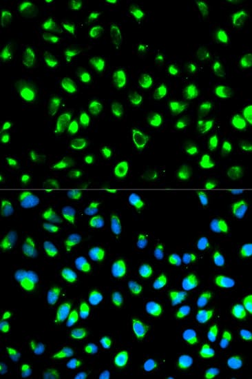 PathPlus™ NDRG1 Antibody