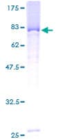 Human SOCS4 Protein (Recombinant GST)