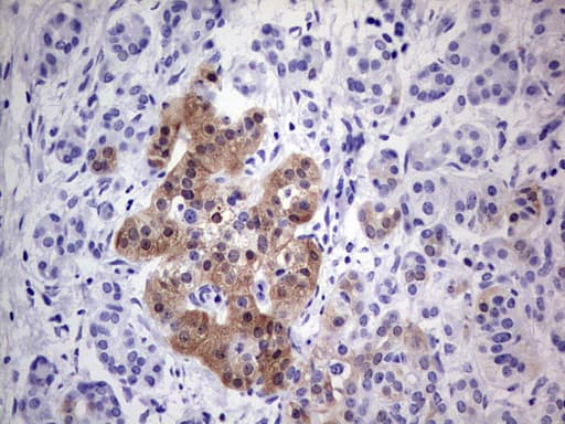 p16INK4a / CDKN2A Antibody (clone OTI2C5)