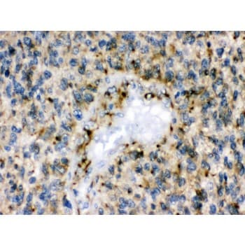Polyclonal Rabbit anti-Human EPHB1 / EPH Receptor B1 Antibody (aa56-88, IHC, WB)