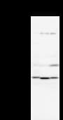 Monoclonal Mouse anti-Human NEIL2 Antibody (clone 2626C2a, WB)