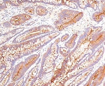CEA / Carcinoembryonic Antigen Antibody (clone COL-1, Ready-to-Use)