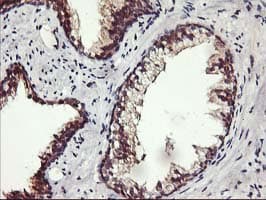 ALG2 Antibody (clone OTI3C2, Carrier-free)