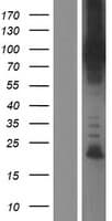 Human GGA1 Protein (Over-Expression Lysate Myc-DDK (Flag))
