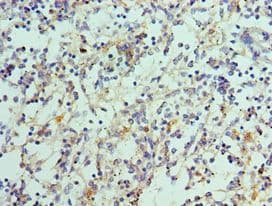 Polyclonal Rabbit anti-Human IL21 Antibody (aa25-162, IHC)