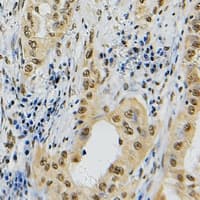 TOP2A / Topoisomerase II Alpha Antibody (C-Terminus)