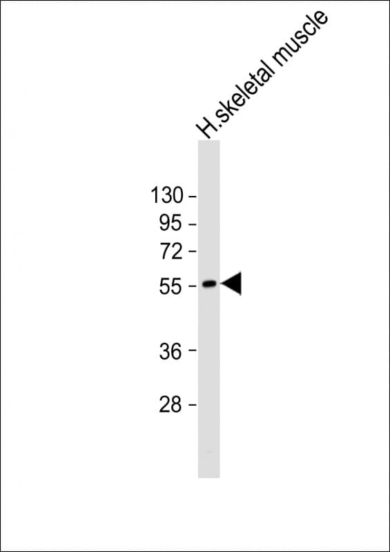CHRM4 / M4 Antibody (aa201-236)