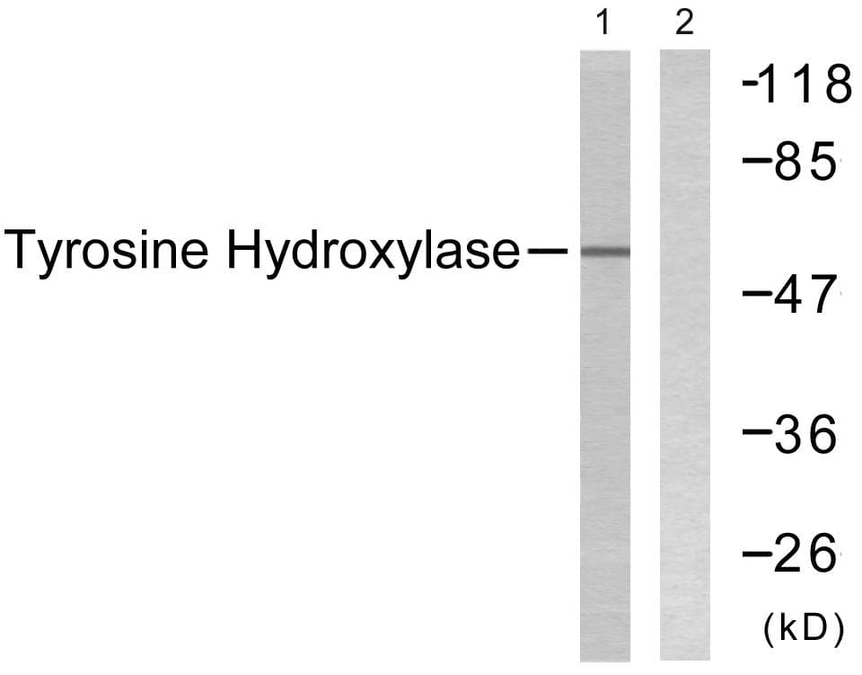 TH / Tyrosine Hydroxylase Antibody (p8)