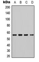 CHEK1 / CHK1 Antibody (phospho-Ser345)
