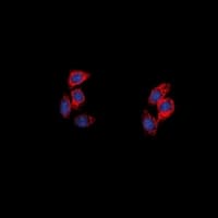 NPY5R Antibody (Internal)