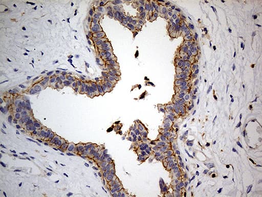 Monoclonal Mouse anti-Human PTH / Parathyroid Hormone Antibody (clone OTI2D3, aa32-115, IHC, WB)