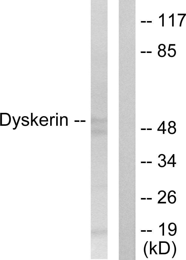 Polyclonal Rabbit anti-Human DKC1 / Dyskerin Antibody (IF, WB)