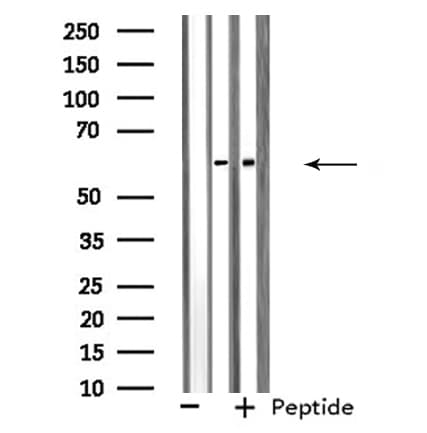 Polyclonal Rabbit anti-Human SNX1 Antibody (IF, WB)