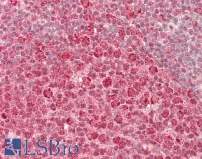 IHC-plus™ NIRF / UHRF2 Antibody