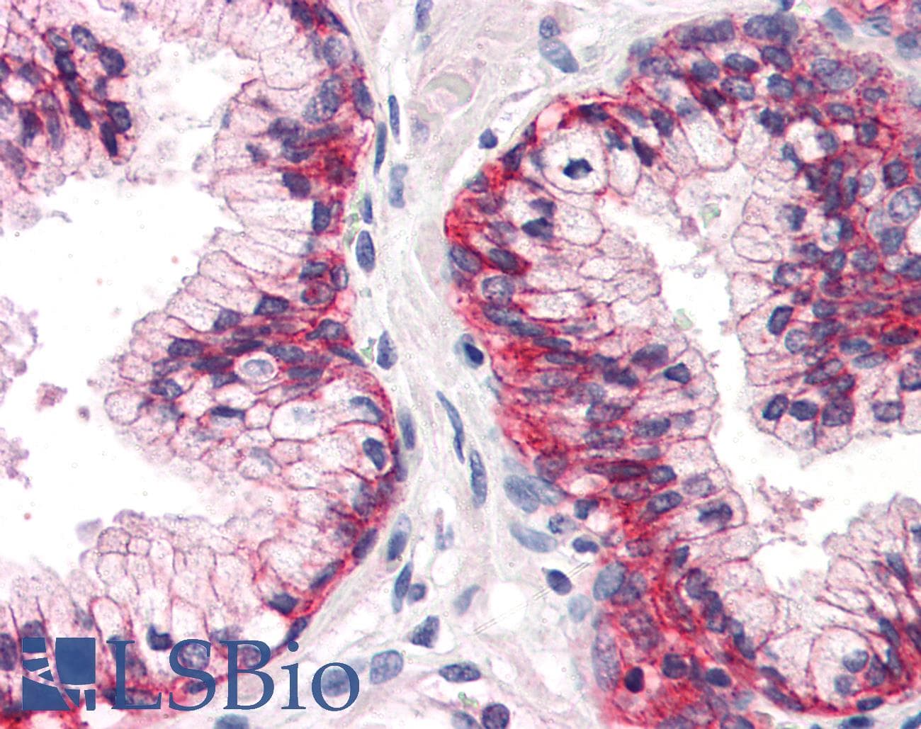 IHC-plus™ ATP1B3 Antibody (Internal)