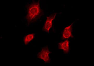 OR7C1 Antibody