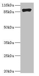 R1 / RRM1 Antibody (aa1-792)