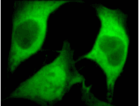UBC / Ubiquitin C Antibody (clone 5B9.B3)
