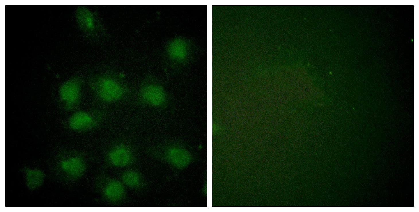 Polyclonal Rabbit anti-Human NIFK / MKI67IP Antibody (phospho-Thr234, IHC, IF)