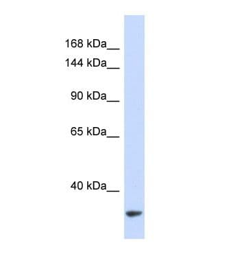 MTBP / Mdm2-Binding Protein Antibody (aa139-188)