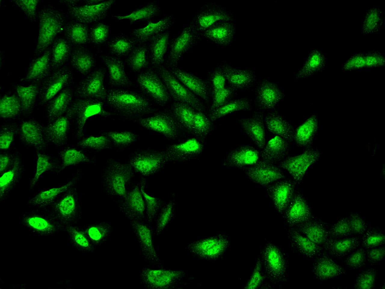 ZNF462 Antibody