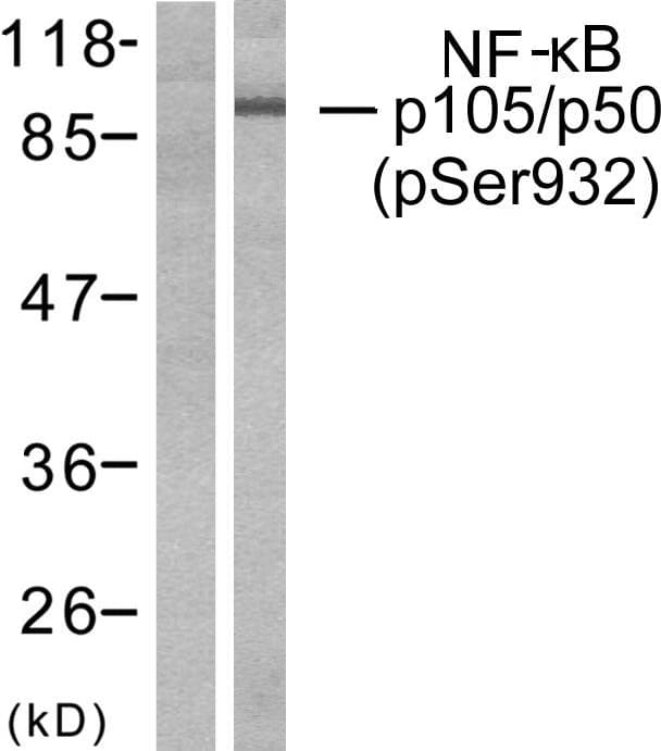 NFKB1 / NF-Kappa-B Antibody (phospho-Ser932)
