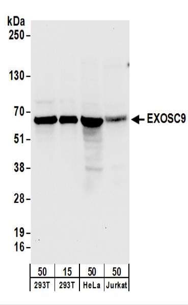 EXOSC9 / p5 Antibody (aa389-439)