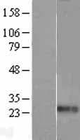 EDN1 / Endothelin 1 Protein (Over-Expression Lysate Myc-DDK (Flag))