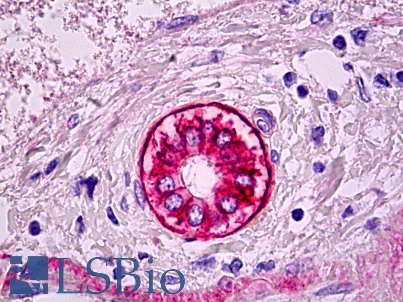 IHC-plus™ CA9 / Carbonic Anhydrase IX Antibody (Extracellular Domain, clone EPR4151(2))